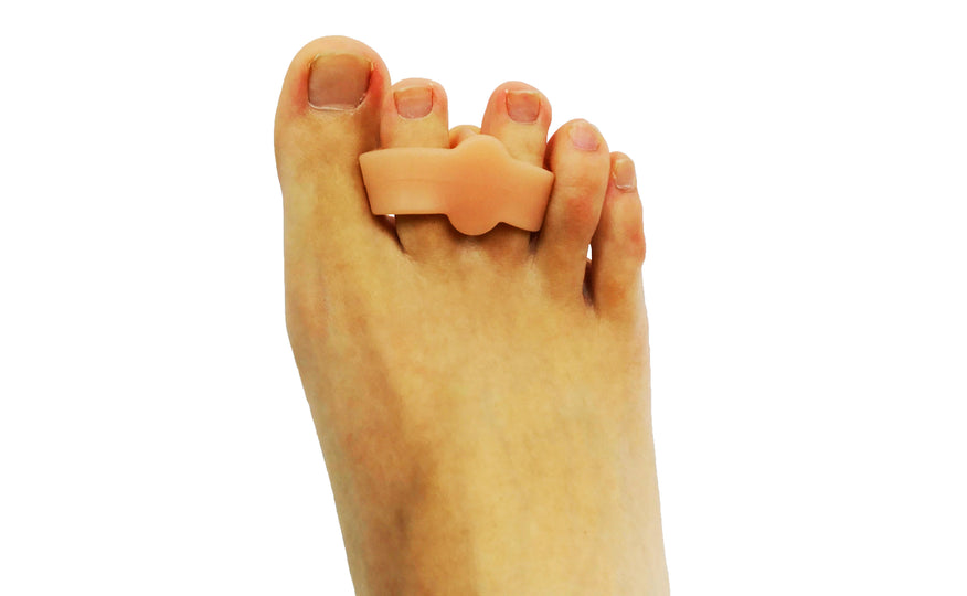 Overlap Fourth Toe Overlapping Toes – Axign Medical Footwear